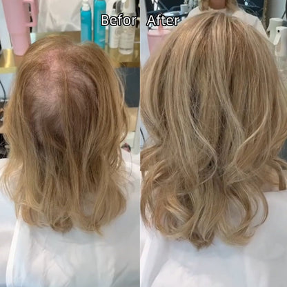 🔥Last Day Promotion🔥2026 New Lightweight & Breathable Wavy Hair Topper
